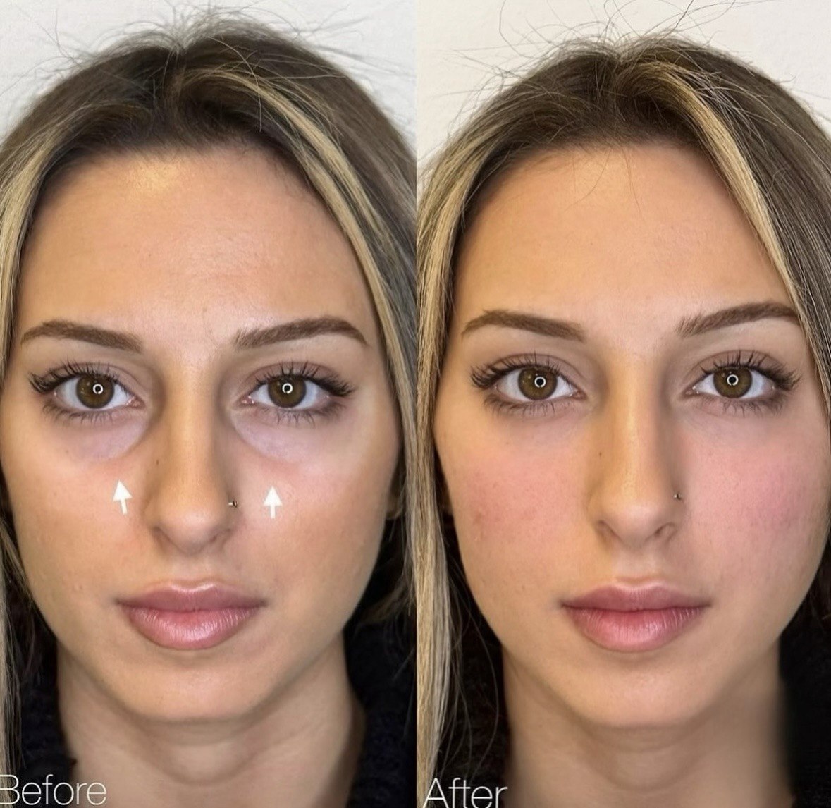 Before and after — case 1