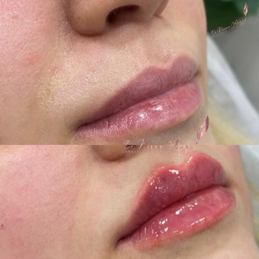 Before and after — case 2
