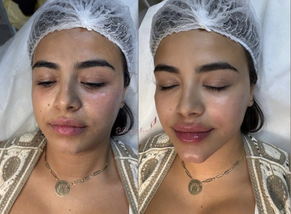 Before and after — case 3