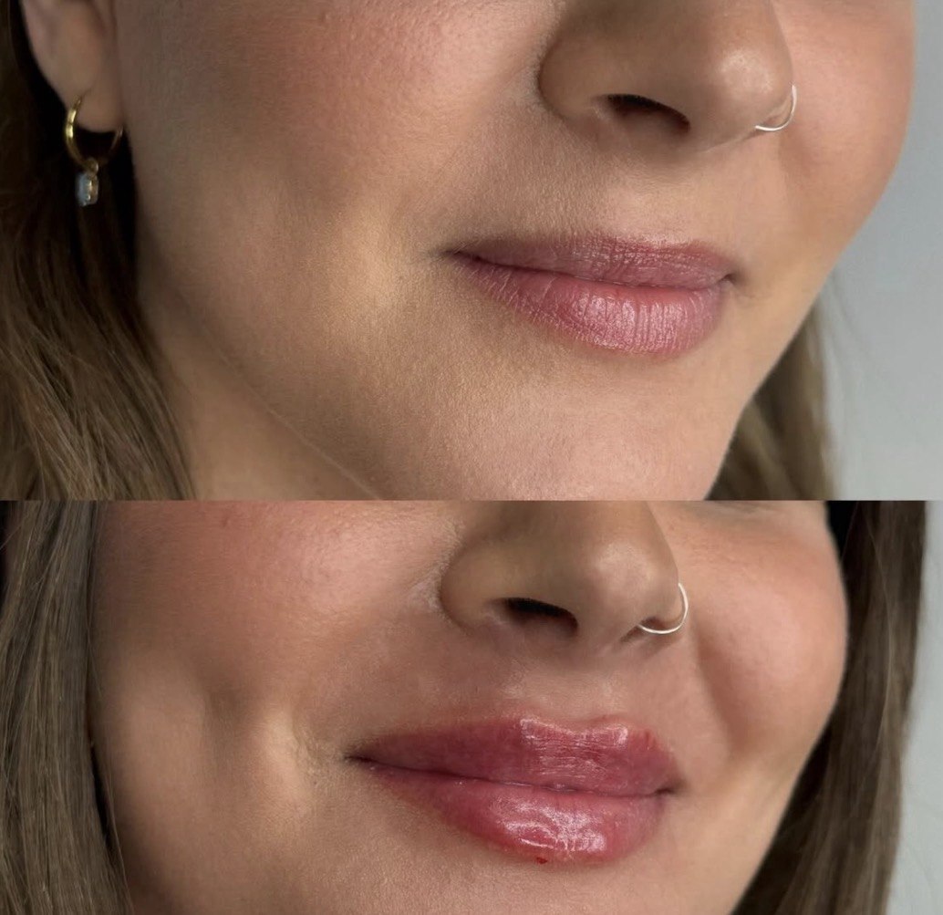 Before and after — case 6