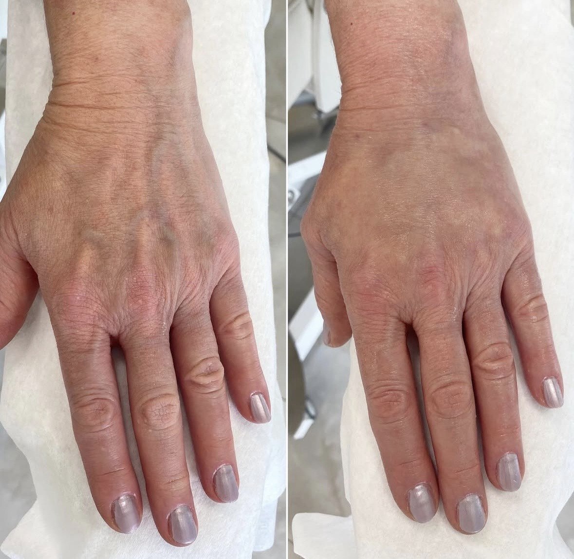 Before and after — case 7